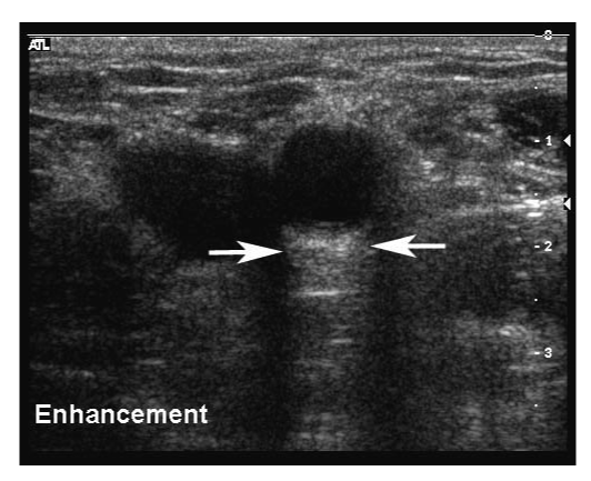 Figure 15 wo caption