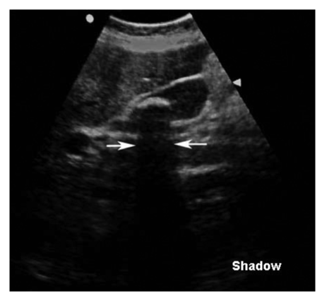 Figure 16 wo caption