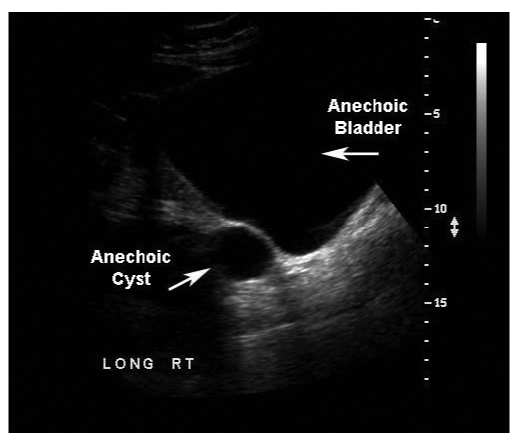 Figure 17 wo caption
