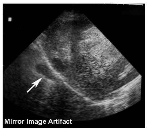 Figure 21 wo caption
