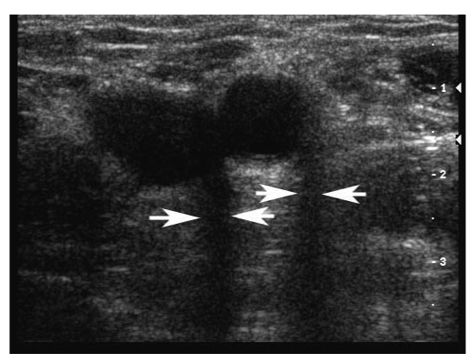 Figure 22 wo caption