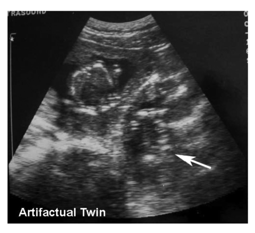 Figure 24 wo caption