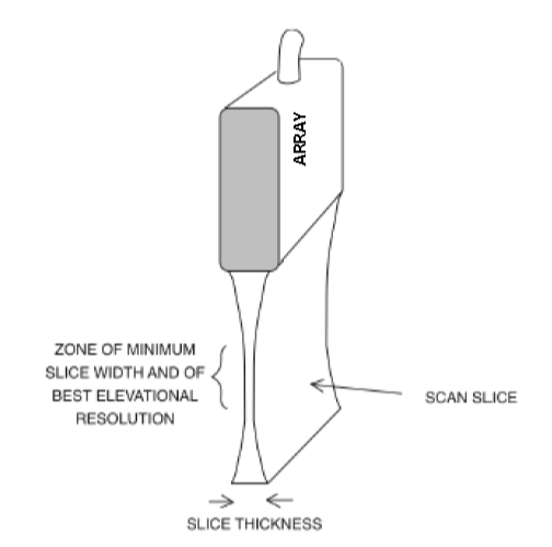 Figure 33 wo caption