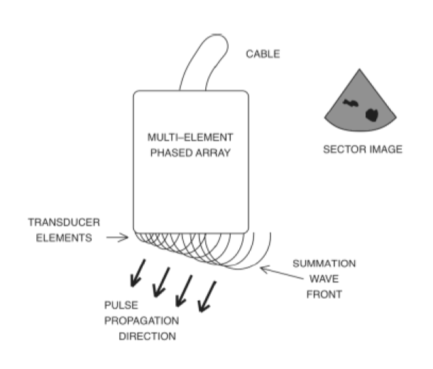 Figure 35 wo caption