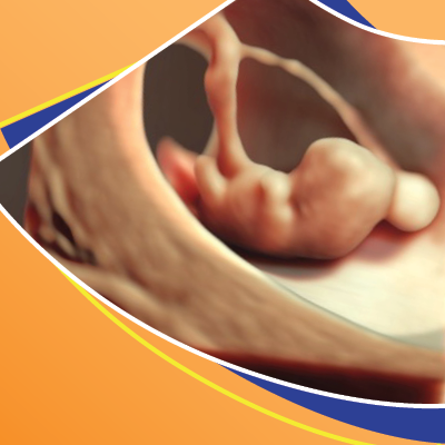 Advanced OB 3 part_Course_Graphics_2025
