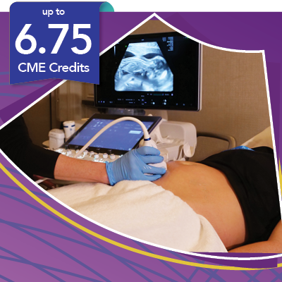 Up to 6.75 CMEs
