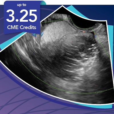 MasterclassGYN_LandingPage_CME 3.25 CME