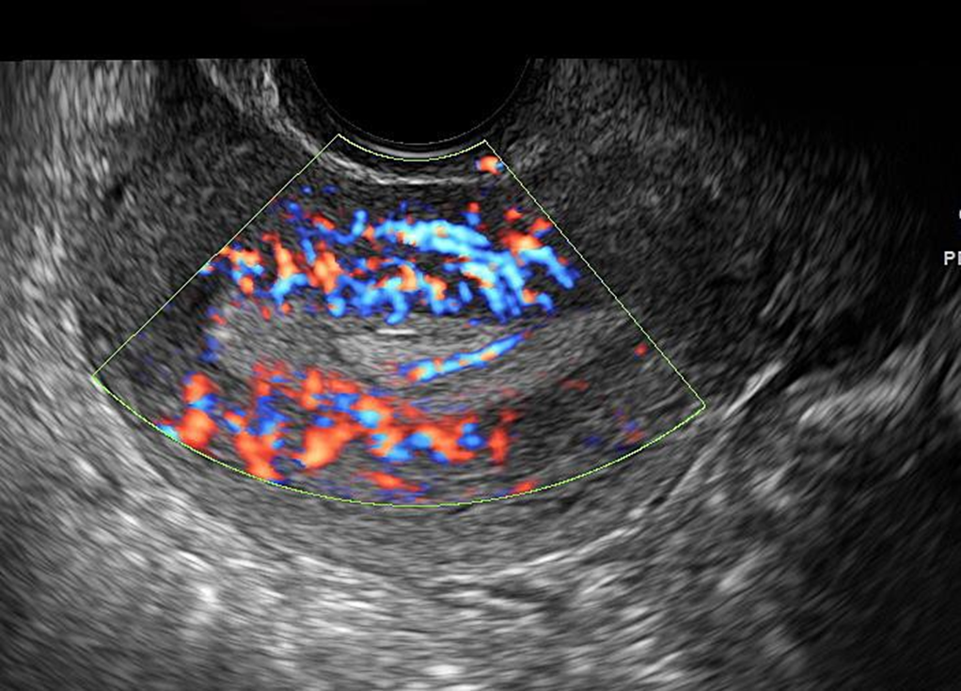 GYN Journal Topic